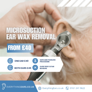 Professional Microsuction Ear Wax Removal in Manchester Radcliffe – Everything Ears